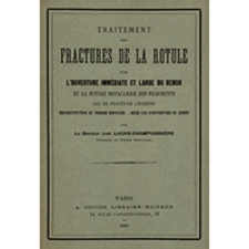 Traitement des fractures de la rotule par l'ouverture imm&eacute;diate et large du genou et la suture m&eacute;tallique des fragments cas de fracture ancienne