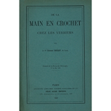 De la main en crochet chez les verriers