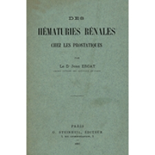 Des h&eacute;maturies r&eacute;nales : chez les prostatiques